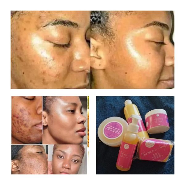 40x PRODUCTS COMBO - Image 2
